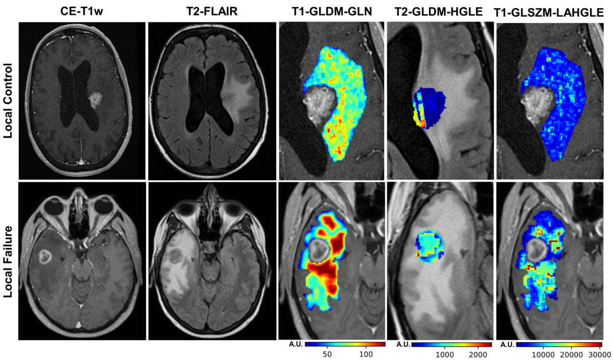 Image of MRI brain scans