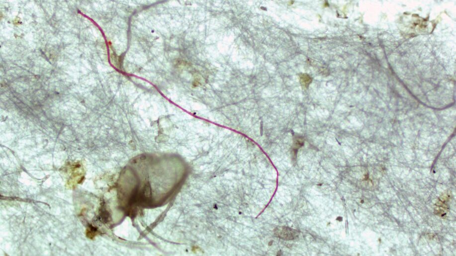 Microplastic particles and fibers, next to a water flea, found in surface waters from Lake Ontario and Hamilton Harbour. Courtesy: Behnam Nayebi, Ph.D. student